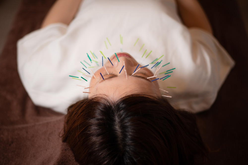 ヘッジホッグ美容鍼の写真